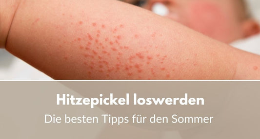 hitzepickel