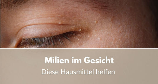 Milien im Gesicht Hausmittel
