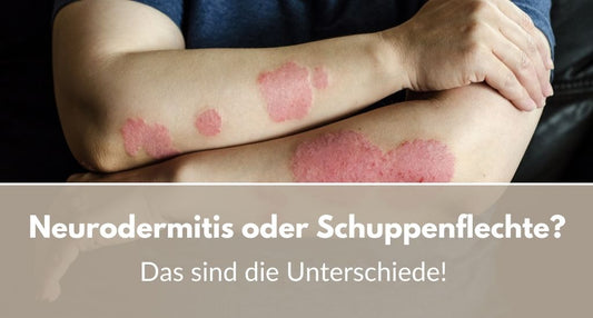 neurodermitis schuppenflechte