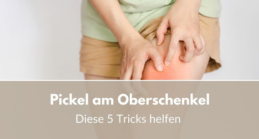 Pickel am Oberschenkel loswerden