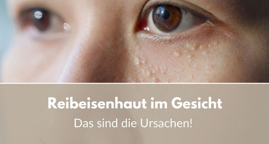 Reibeisenhaut im Gesicht