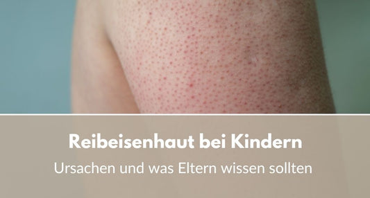 reibeisenhaut bei kindern ursachen und tipps